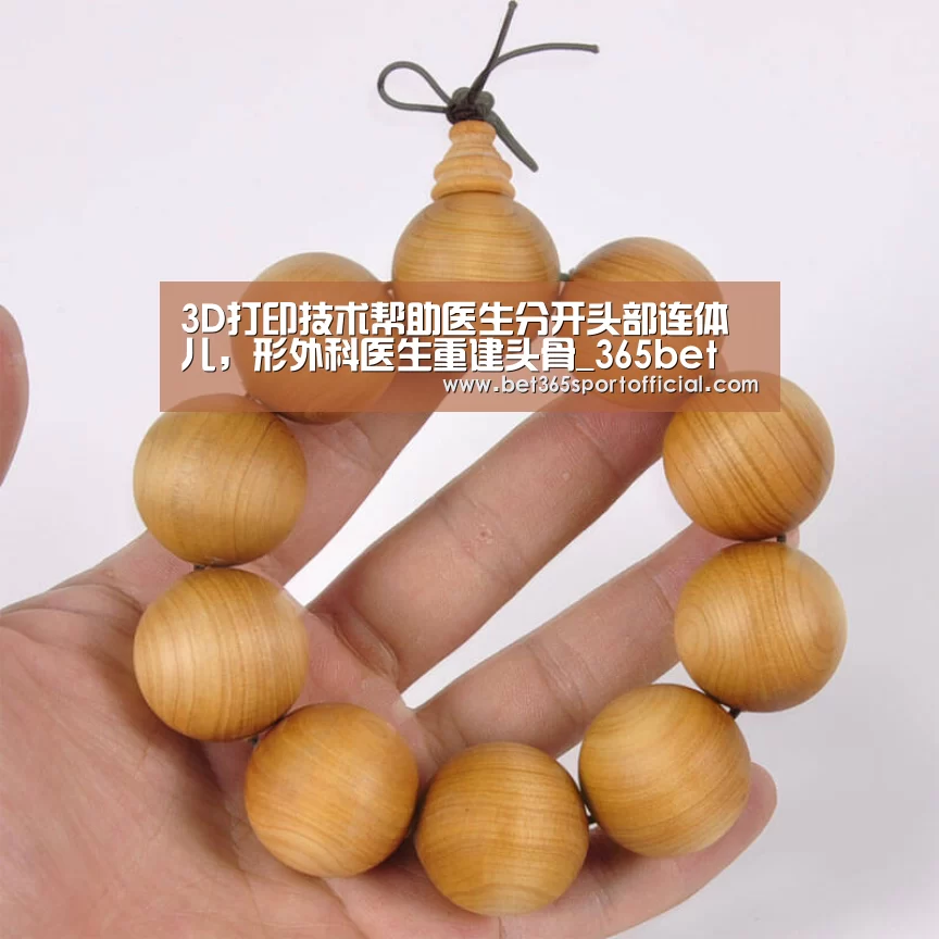 3D打印技术帮助医生分开头部连体儿,形外科医生重建头骨_365bet(图2) 3D打印技术帮助医生分开头部连体儿,形外科医生重建头骨_365bet(图2)
