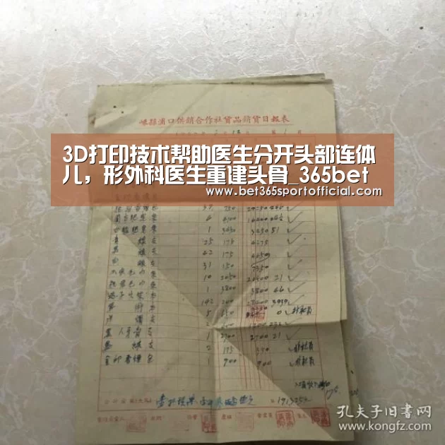 3D打印技术帮助医生分开头部连体儿,形外科医生重建头骨_365bet(图4) 3D打印技术帮助医生分开头部连体儿,形外科医生重建头骨_365bet(图4)